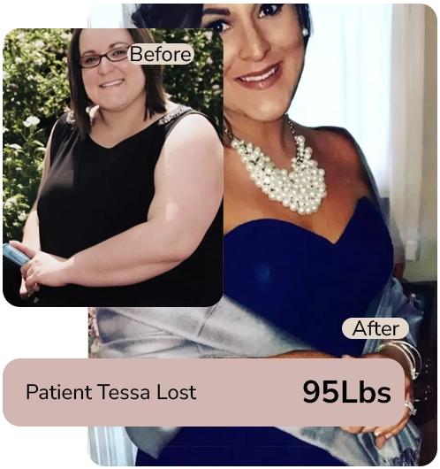 Leanefy telehealth weight loss before and after patient results